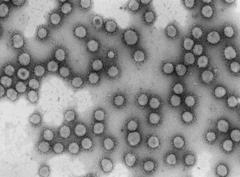 Foto cedida por el Centro Superior de Investigaciones Científicas de un virus de la familia coronaviridae
