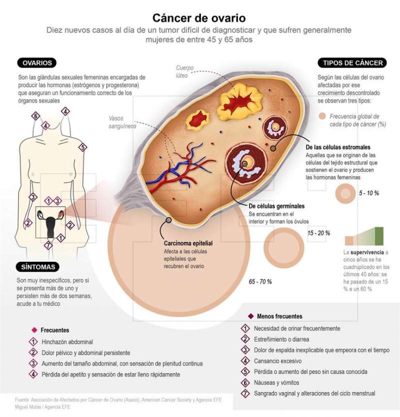 Detalle de la infografía de la Agencia EFE  Detalle de la infografía de la Agencia EFE