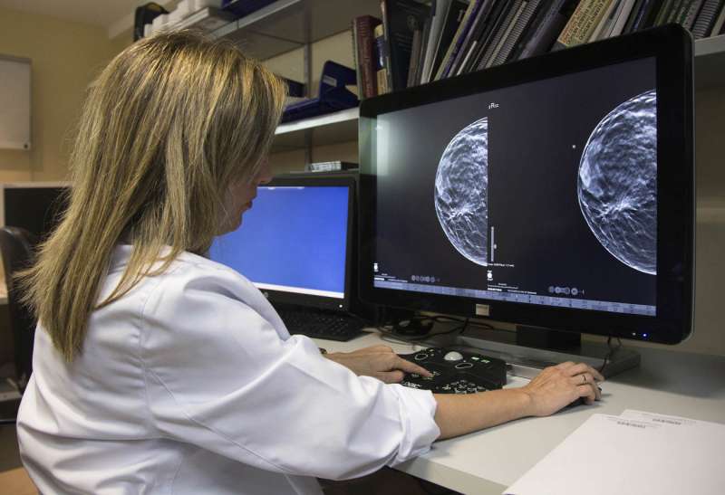 Una especialista realiza una revisión de una mamografía. EFE/ Miguel Angel Polo/Archivo
