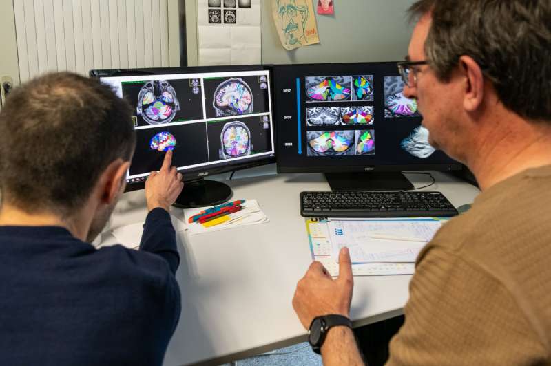 El profesor José Vicente Manjón, que lidera el grupo de investigación MIA-LAB, y el investigador del grupo Sergio Morell. EFE/UPV
