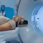 Nuevo TAC con inteligencia artificial incorporado por Affidea Clínica Tesla en Elche para reforzar su capacidad diagnóstica.
